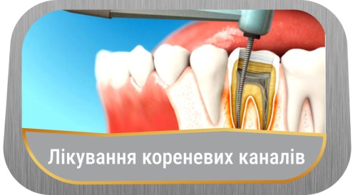 lik-kornevih-kanaliv