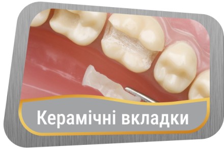 protez-keram-vkladki