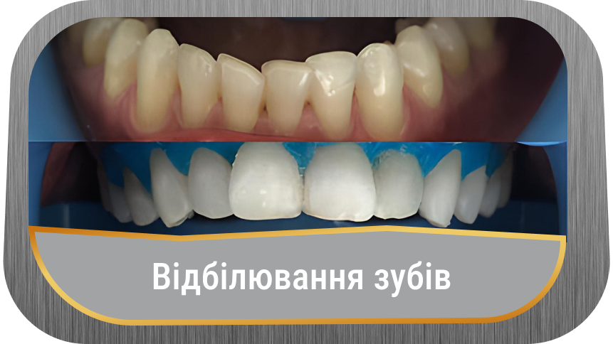 vidbiluvannia